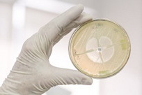 Antibiotic gel plate quicklink