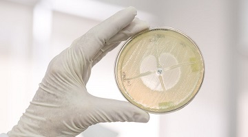 Antibiotic gel plate2